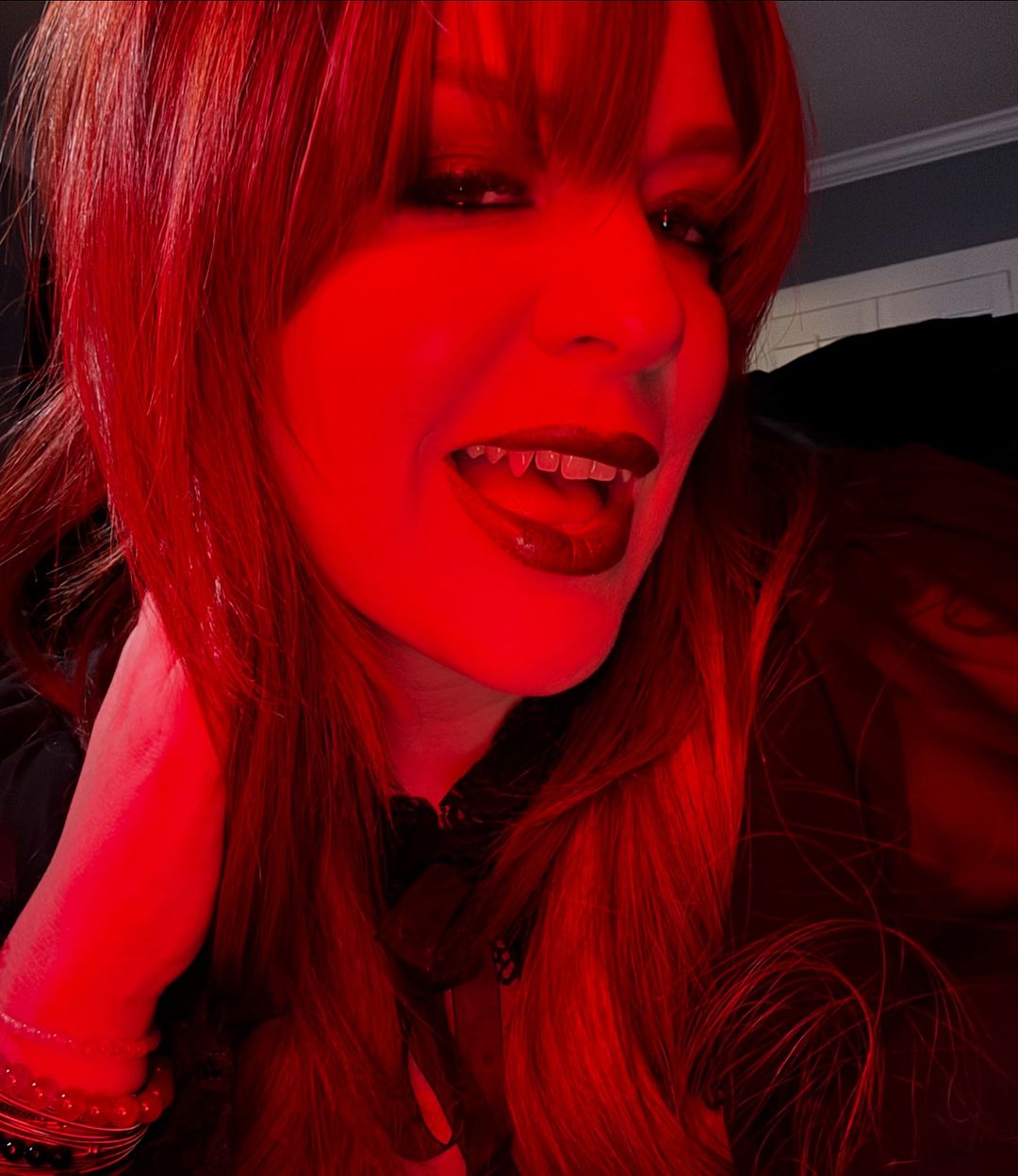 Permanent vampire fangs patient Las Vegas - Vegas Smile Suite